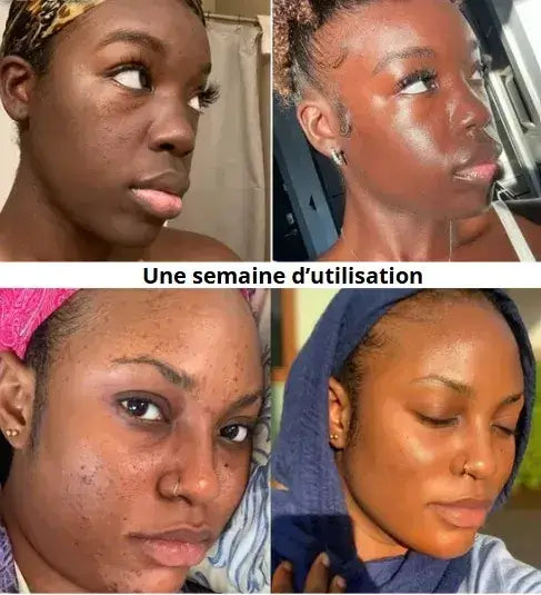 Le Masque Coréen: Dites adieu aux taches du soleil!