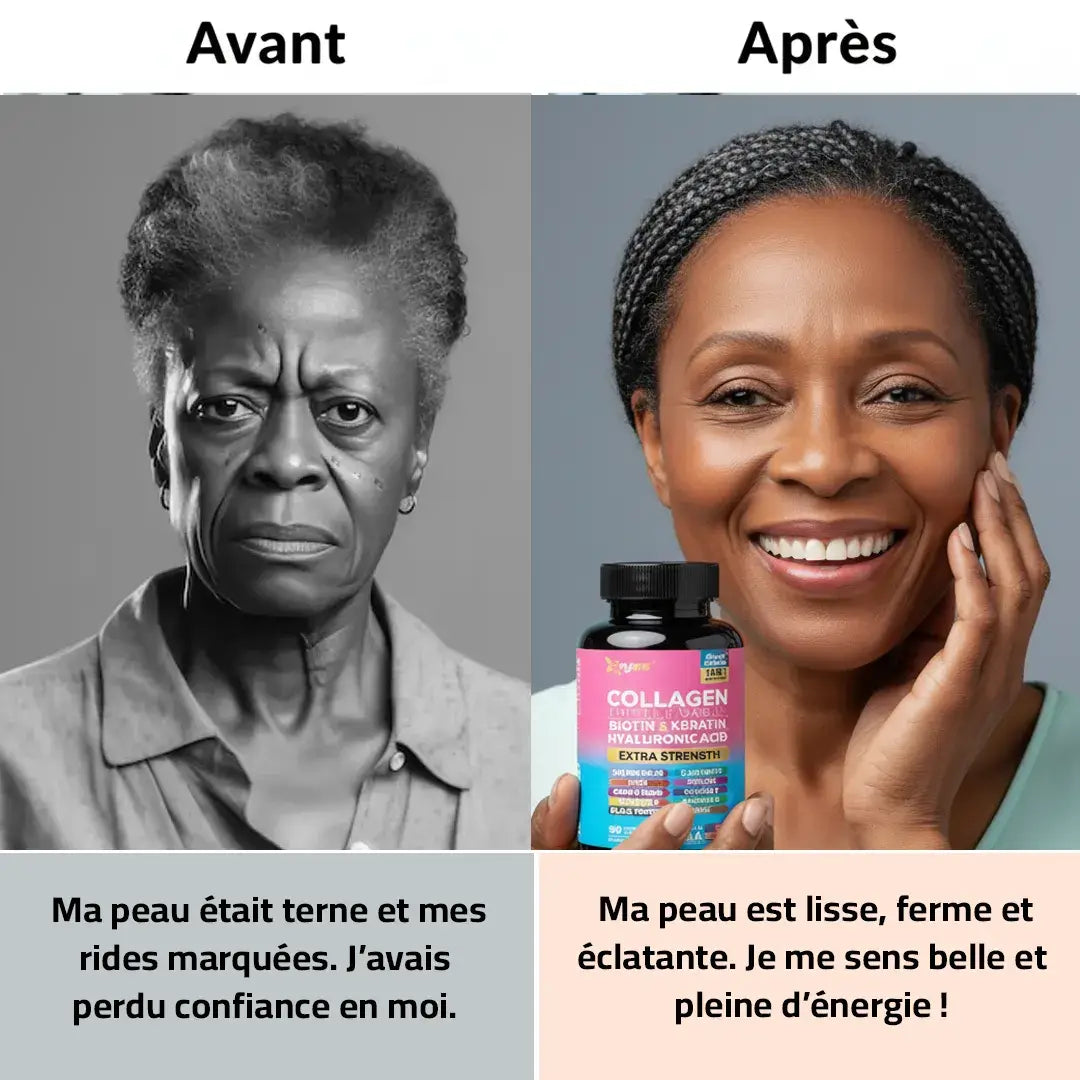 Collagène 14 en 1 pour une beauté naturelle