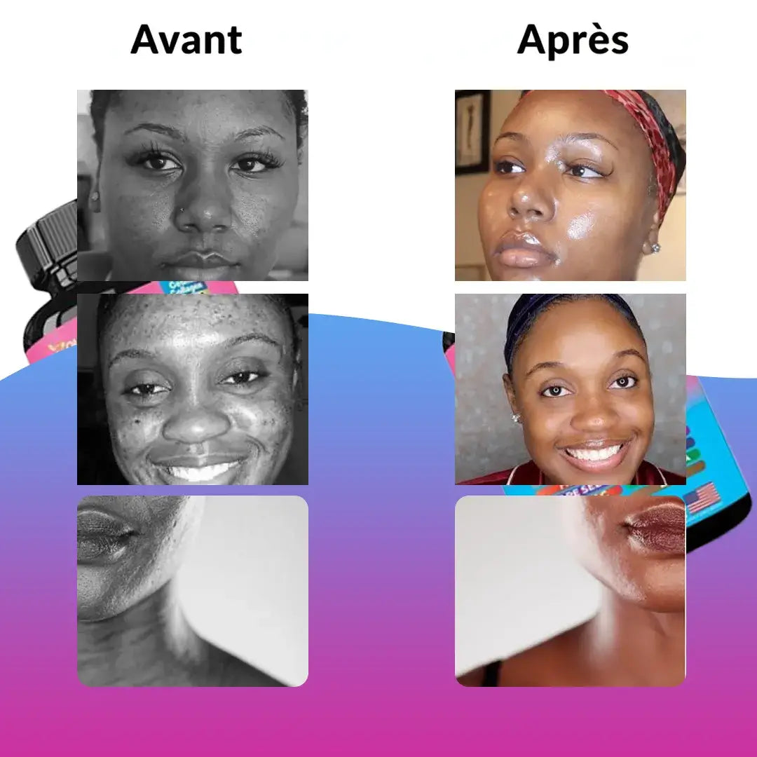 Collagène 14 en 1 pour une beauté naturelle