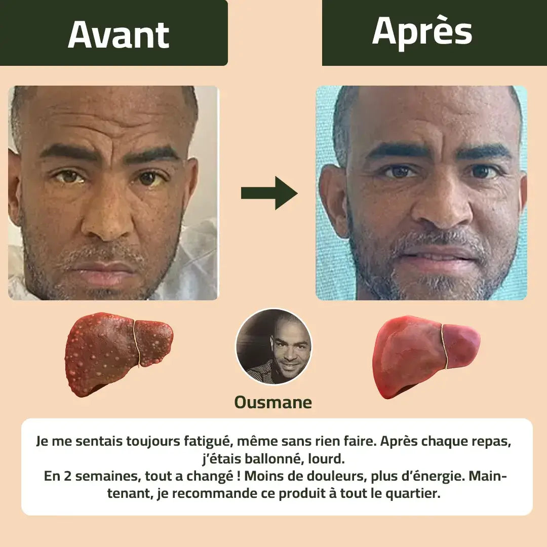 Nettoyez votre foie, protégez votre santé dès aujourd’hui !