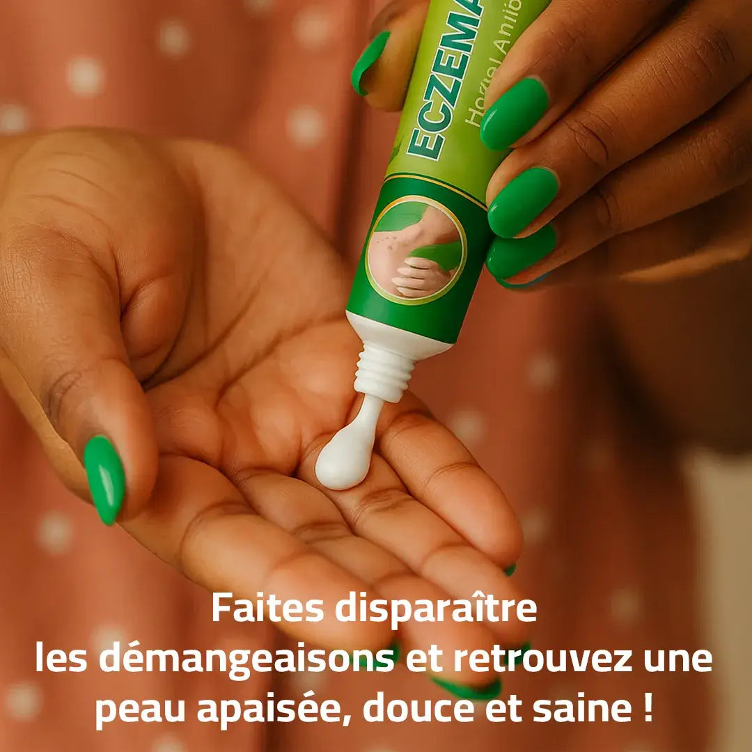 Crème anti-démangeaison : votre solution contre l’eczéma et l'irritation !