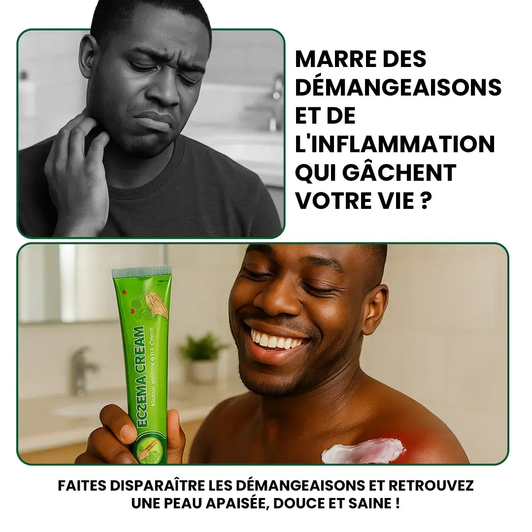 Crème anti-démangeaison : votre solution contre l’eczéma et l'irritation !