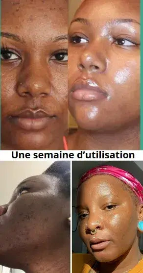 Le Masque Coréen: Dites adieu aux taches du soleil!