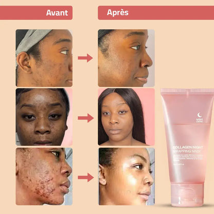 Le Masque Coréen: Dites adieu aux taches du soleil!