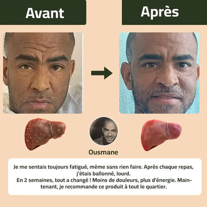 Nettoyez votre foie, protégez votre santé dès aujourd’hui !