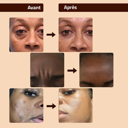 Crème Éclat Visage au Rétinol – Dites Adieu aux Taches et Rides !