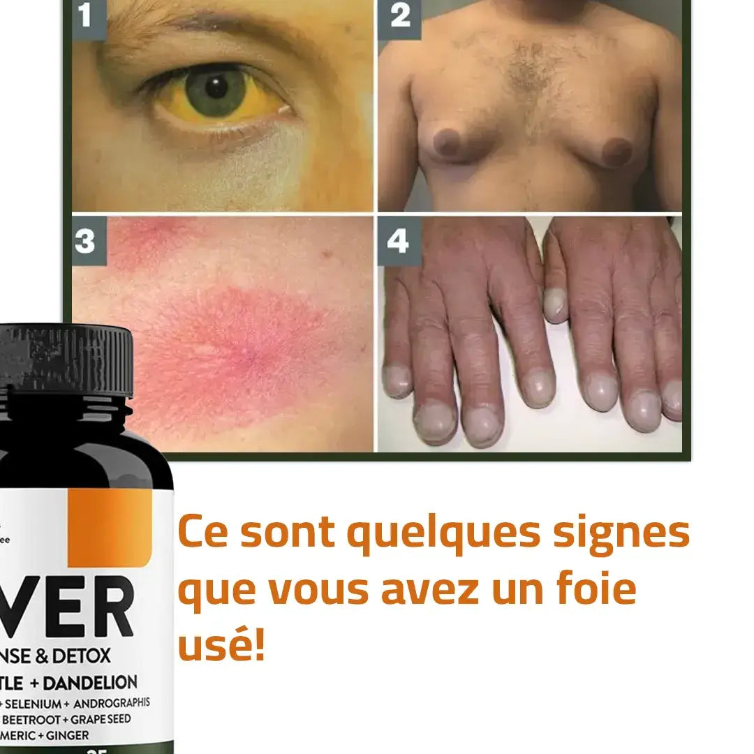 Nettoyez votre foie, protégez votre santé dès aujourd’hui !
