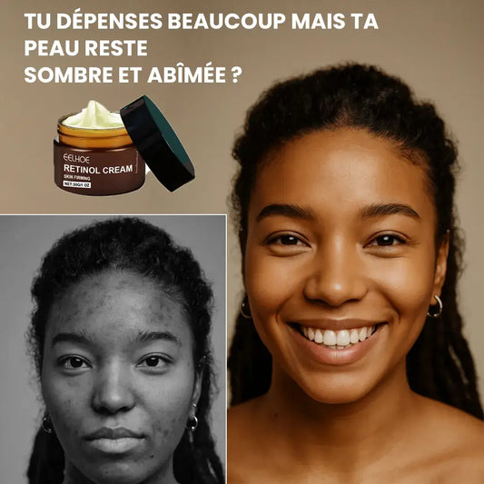 Crème Éclat Visage au Rétinol – Dites Adieu aux Taches et Rides !