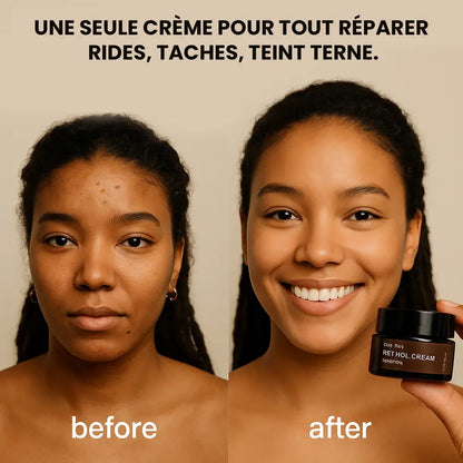 Crème Éclat Visage au Rétinol – Dites Adieu aux Taches et Rides !
