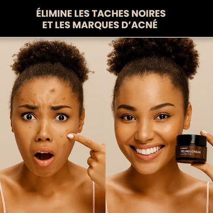 Crème Éclat Visage au Rétinol – Dites Adieu aux Taches et Rides !