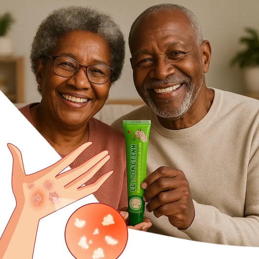 Crème anti-démangeaison : votre solution contre l’eczéma et l'irritation !