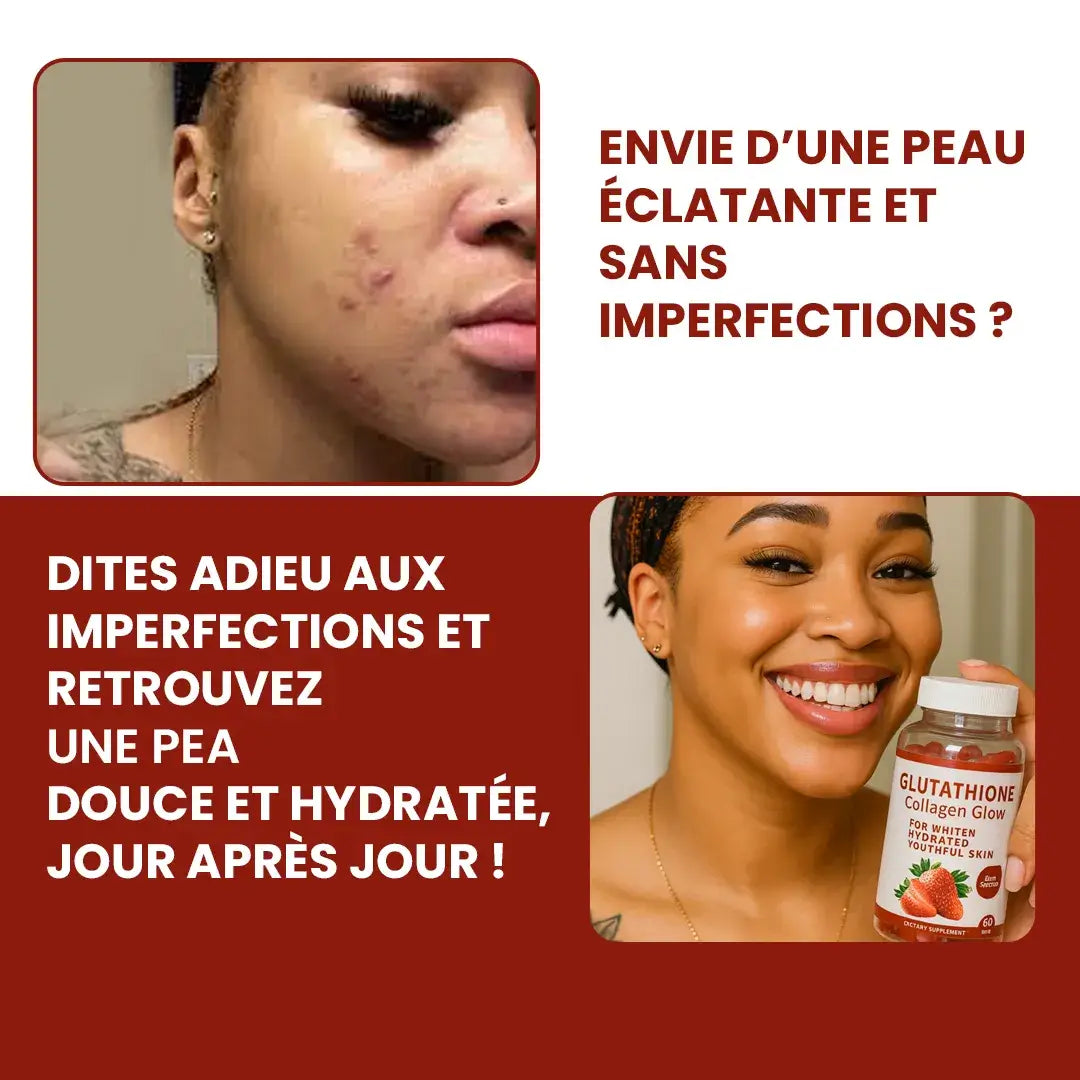 Gummies Hydratantes: Une Peau Éclatante et Douce Comme du Verre