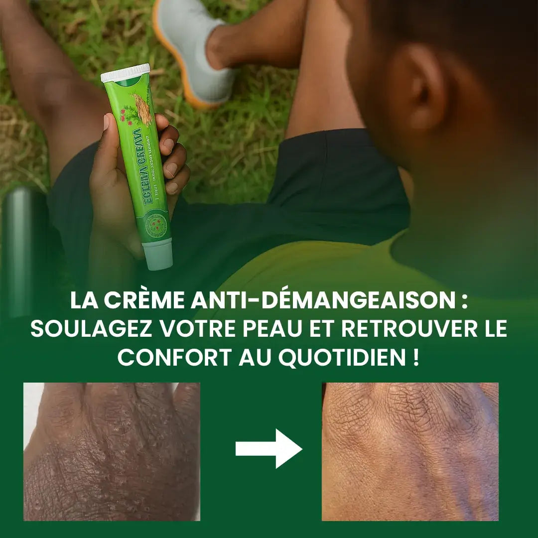 Crème anti-démangeaison : votre solution contre l’eczéma et l'irritation !